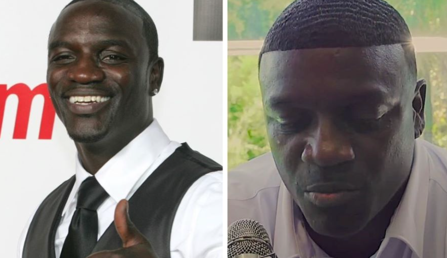 Celebrity Hair Transplants: Confirmed Cases, Costs, Photos related image