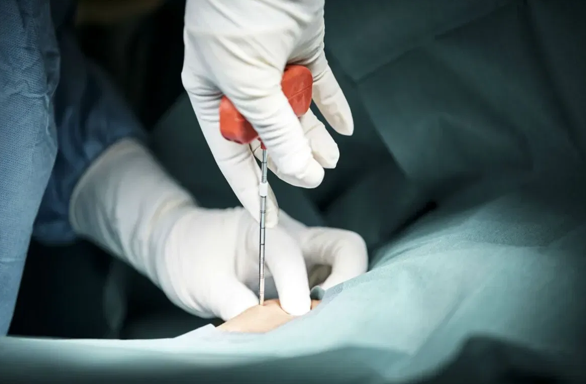 Pediatric Bone Marrow Transplant in Turkey related image