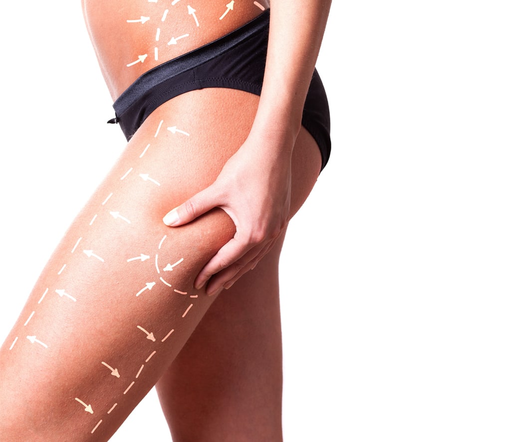 Thigh Lift in Turkey related image