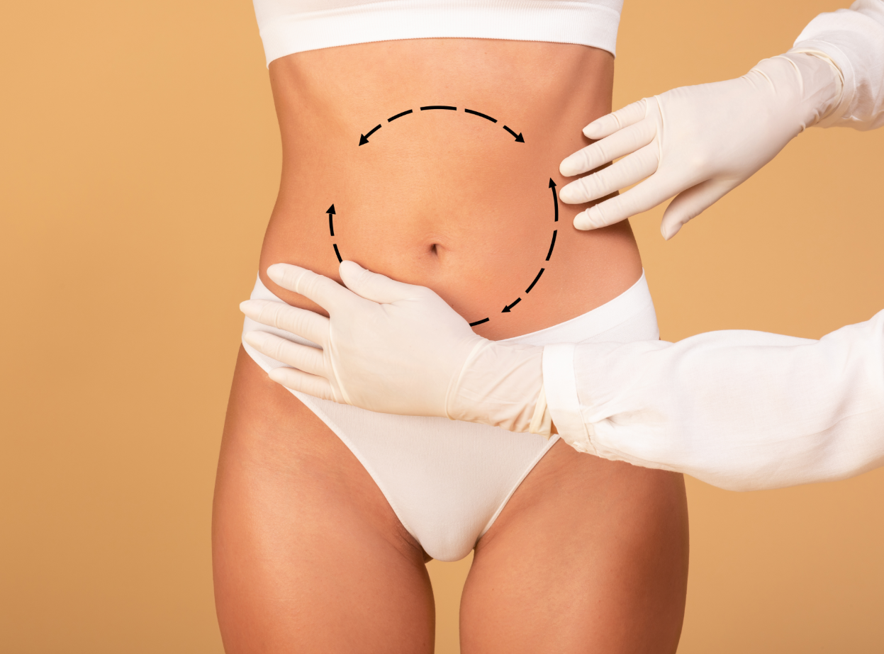 360 Liposuction in Turkey related image
