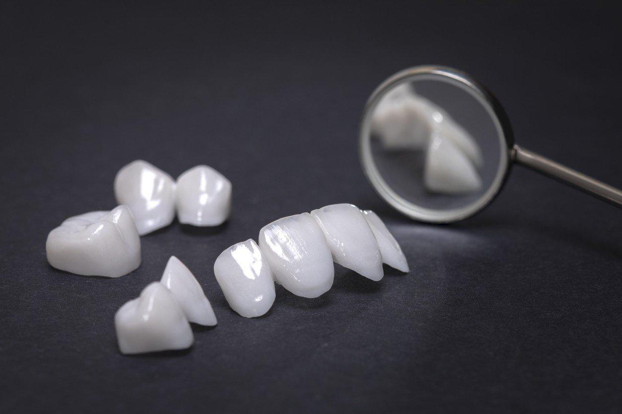 Zirconia Crowns in Turkey related image