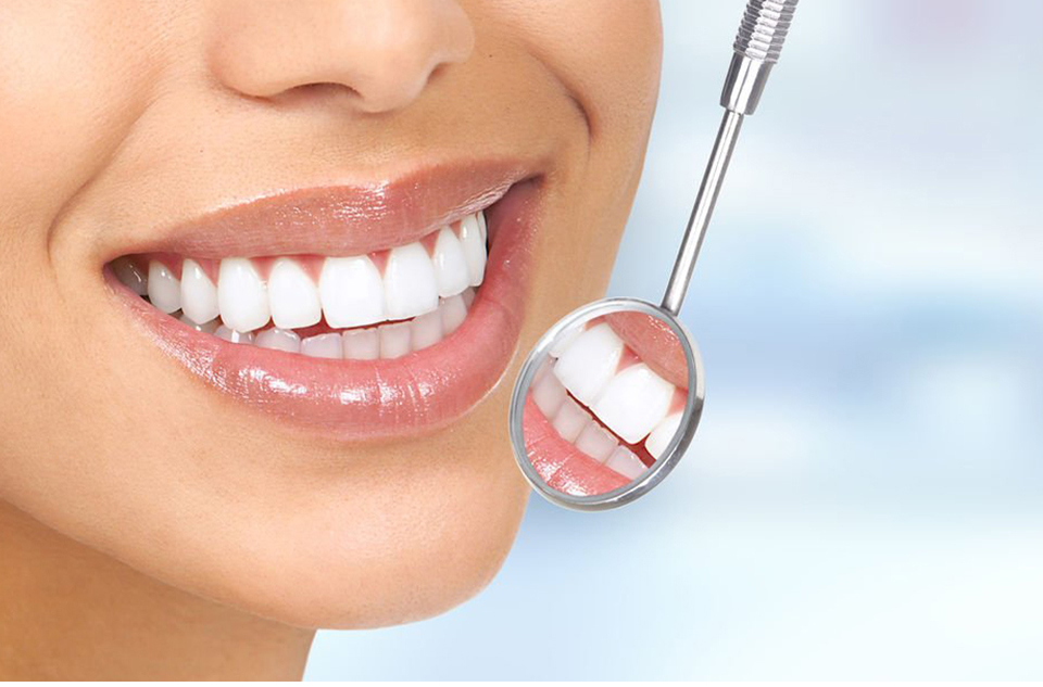 Hollywood Smile in Turkey related image