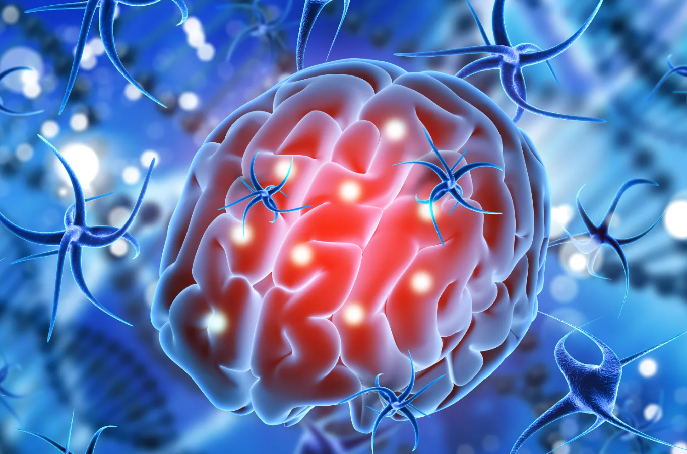 Glioblastoma Treatment Abroad related image