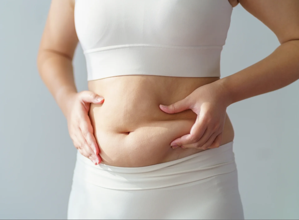 Mini Tummy Tuck in Turkey related image