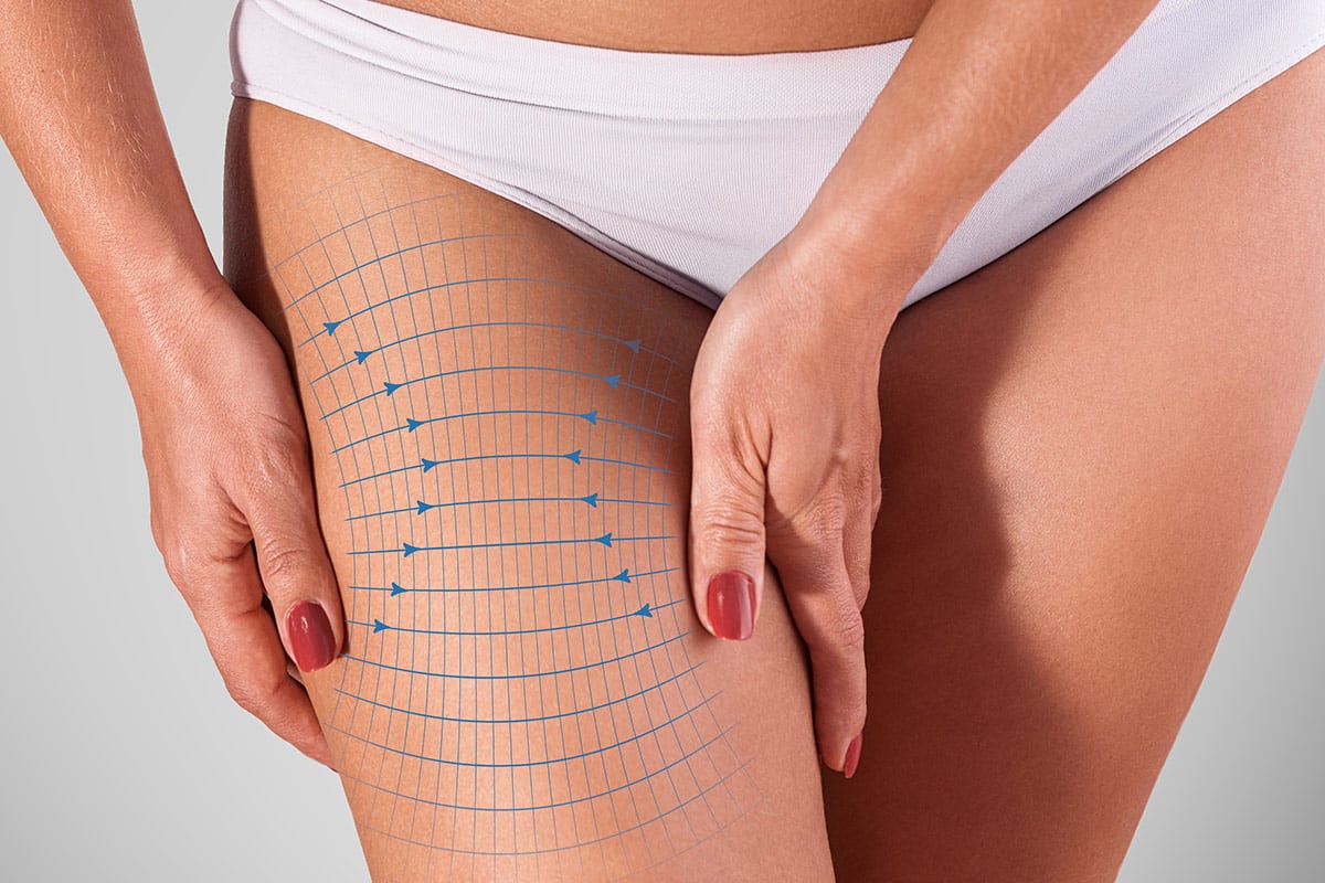 Thigh Lift in Turkey related image