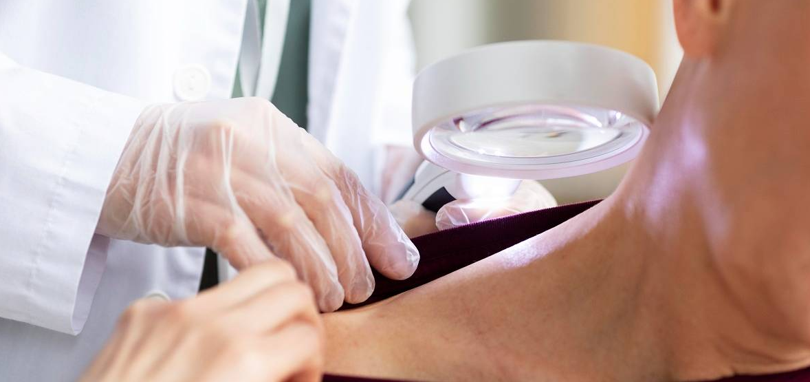 Head and Neck Cancer Treatment Abroad related image