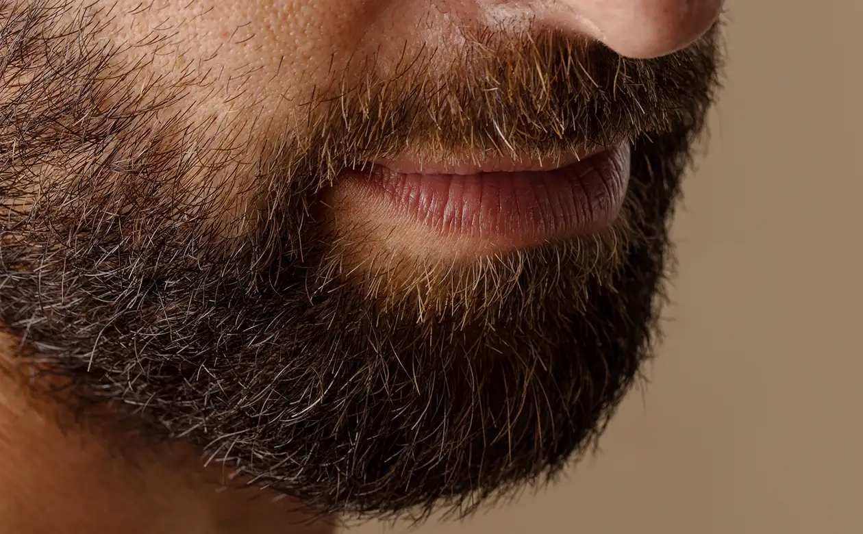 Beard Transplant in Turkey related image