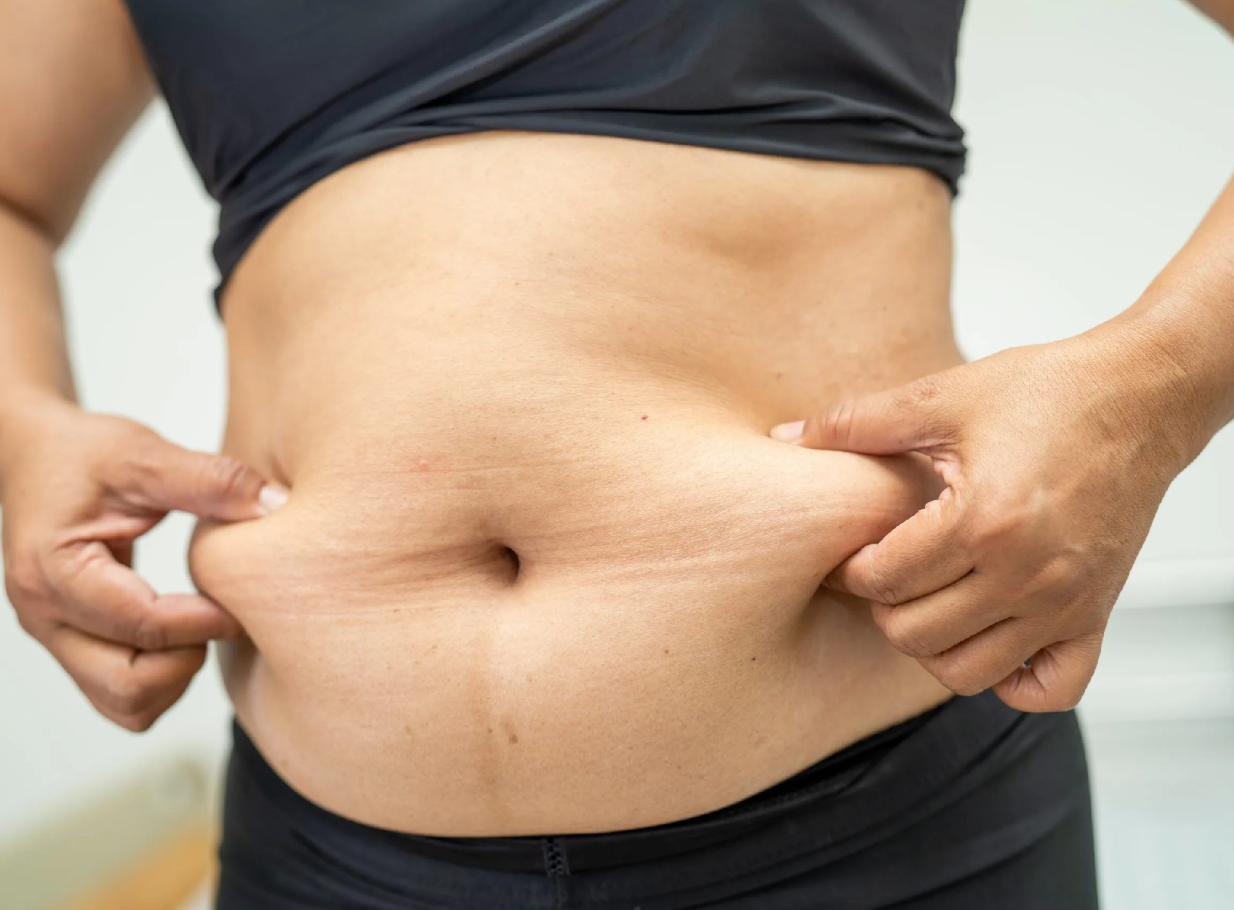 Mini Tummy Tuck in Turkey related image