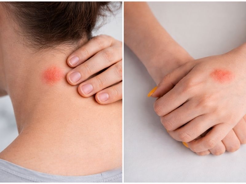 Sarcoma Treatment Abroad related image