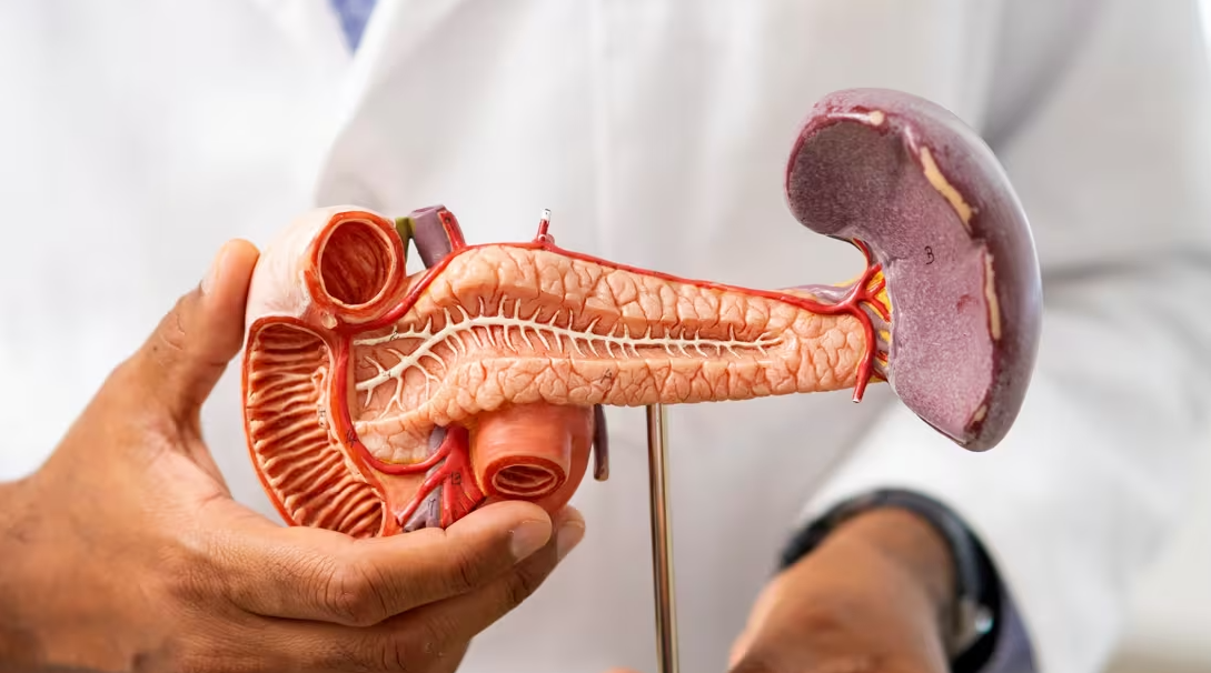Pancreas Transplant Abroad related image