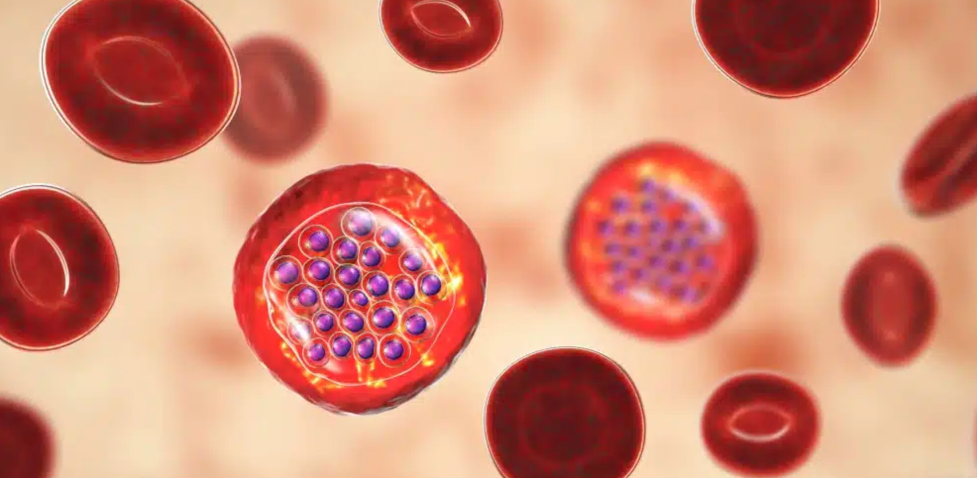 Leukemia Treatment Abroad - Best Countries, Clinics & Doctors related image