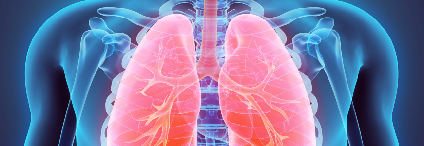 Lung Transplant Abroad related image