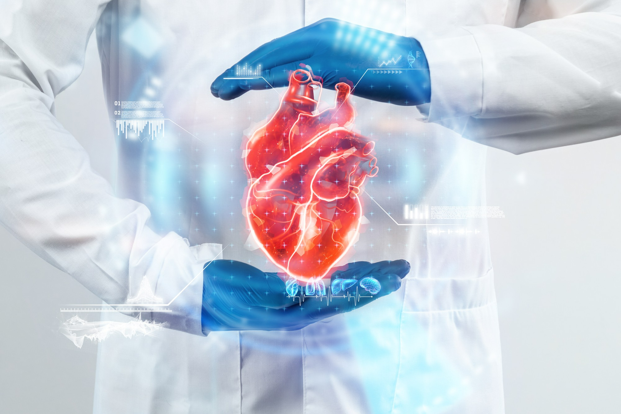 Heart Transplant Abroad related image
