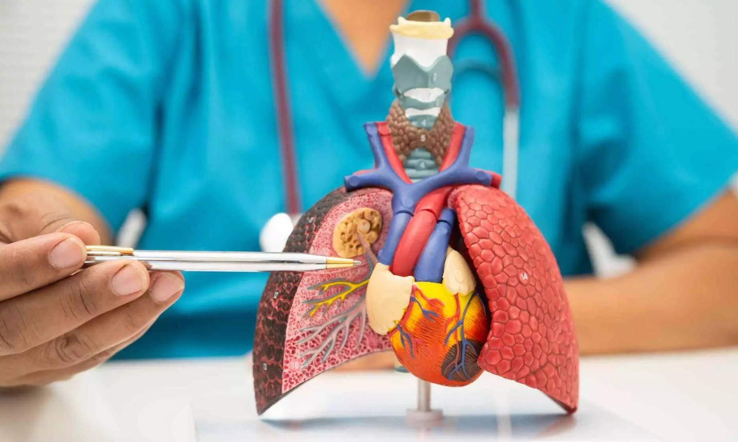 Lung Transplant Abroad related image