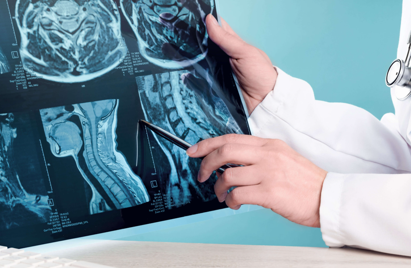 Head and Neck Cancer Treatment Abroad related image