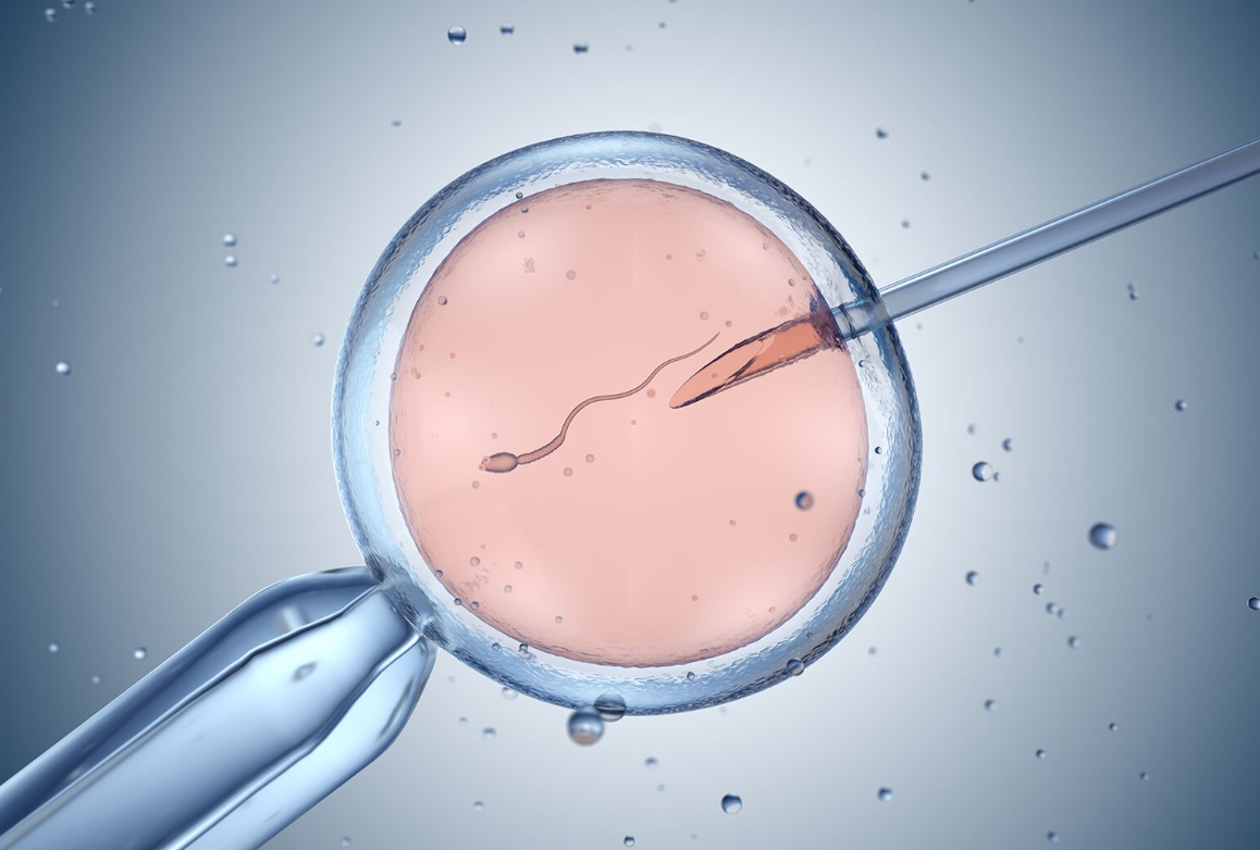 IVF in Spain | 2026 Costs & Best Clinics related image