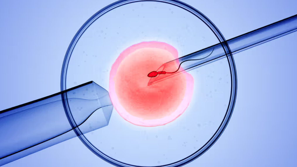 IVF in Spain | 2026 Costs & Best Clinics related image
