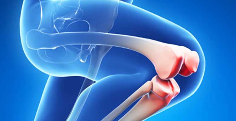 Total Knee Replacement in Spain related image