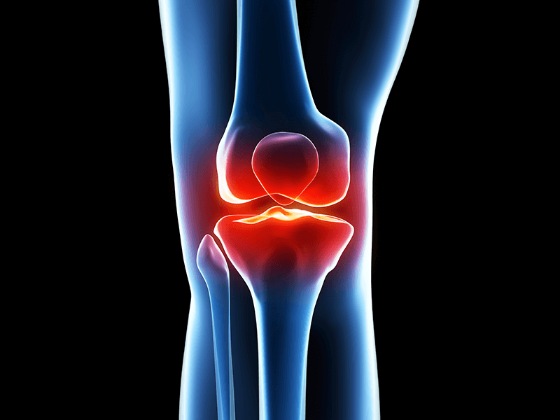 Best Clinics for Total Knee Replacement Surgery Abroad,
A-Medical - With more than 7 years of experience in the field of treatment in Turkey, treatment abroad and medical tourism, we serve those who want to receive treatment in Turkey and abroad!
